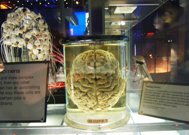 Human Brain Museum