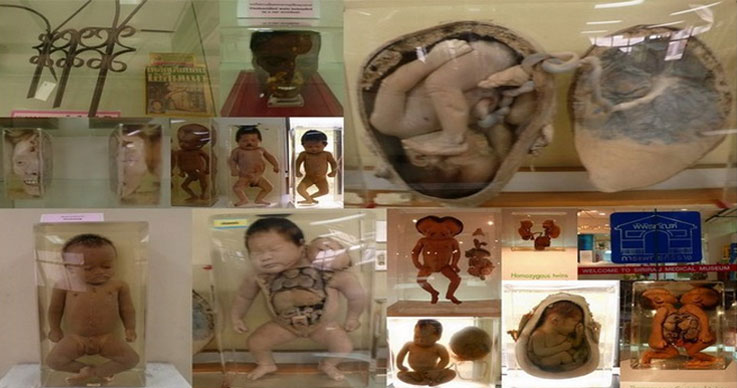 Interesting Visit of Siriraj Medical Museum